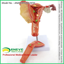 SELL 12473 Human Medical Science Female Uterine Pathological Model